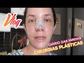 Diário Pós Cirúrgico Da Minha RINOPLASTIA MENTOPLASTIA PRÓTESE DE SILICONE Carol Borba