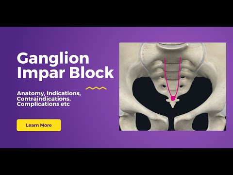 Mastering the Ganglion Impar Block: Anatomy, Procedure, and Applications