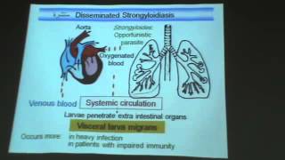 Dr Azza   Parasitology   Nematodes 4   strongyloides stercoralis   capillaria philippinensis   YouTu
