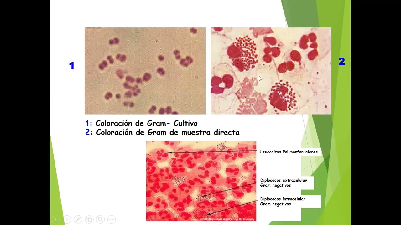 neisseria meningitidis 1