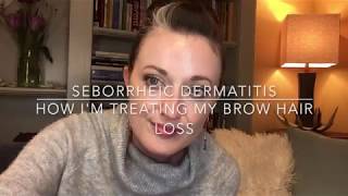 Eyebrow Hair Loss | Seborrheic Dermatitis | Julene Beeson