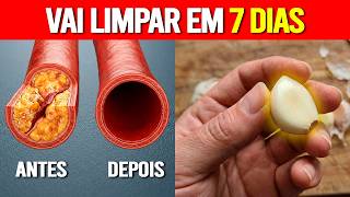 O DETERGENTE das ARTÉRIAS: Como Desentupir Veias Sem Cirurgia