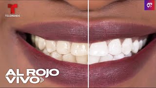 La Blancorexia: una peligrosa obsesión por tener dientes blancos siempre