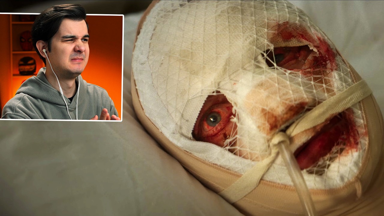 ГЛИНОЛИКИЙ  РЕАКЦИЯ НА ТРЕЙЛЕР