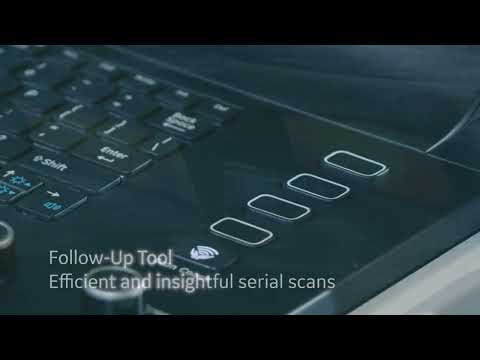 GE Versana Premier Black