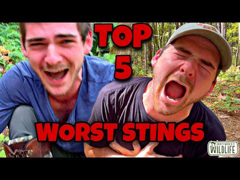 TOP 5 WORST STINGS! RANKING My Most Painful Sting Tests