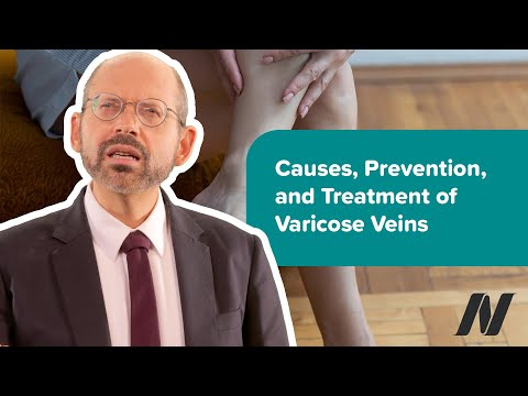 Causes, Prevention, and Treatment of Varicose Veins