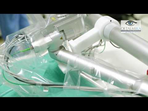 Laser femtosekundowy w okulistyce i mikrochirurgii oka - www.oftalmika.pl