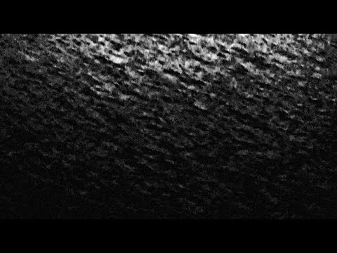 [TEASER] HEADS. / CLOSET DISCO QUEEN - SPLIT 7" (CSR001)