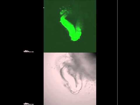 Siccome è spesso possibile fare un pacco di faccia di prezzemolo Il pacco di faccia nazionale per restringersi di un tempo