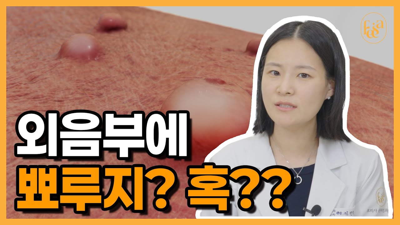 외음부에 뭔가 만져져요? ???? 외음부 종기, 혼자 걱정 마세요!