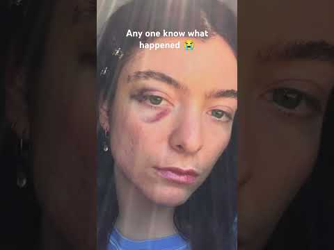 What happened 😭 #lorde #lordefan #music #singer