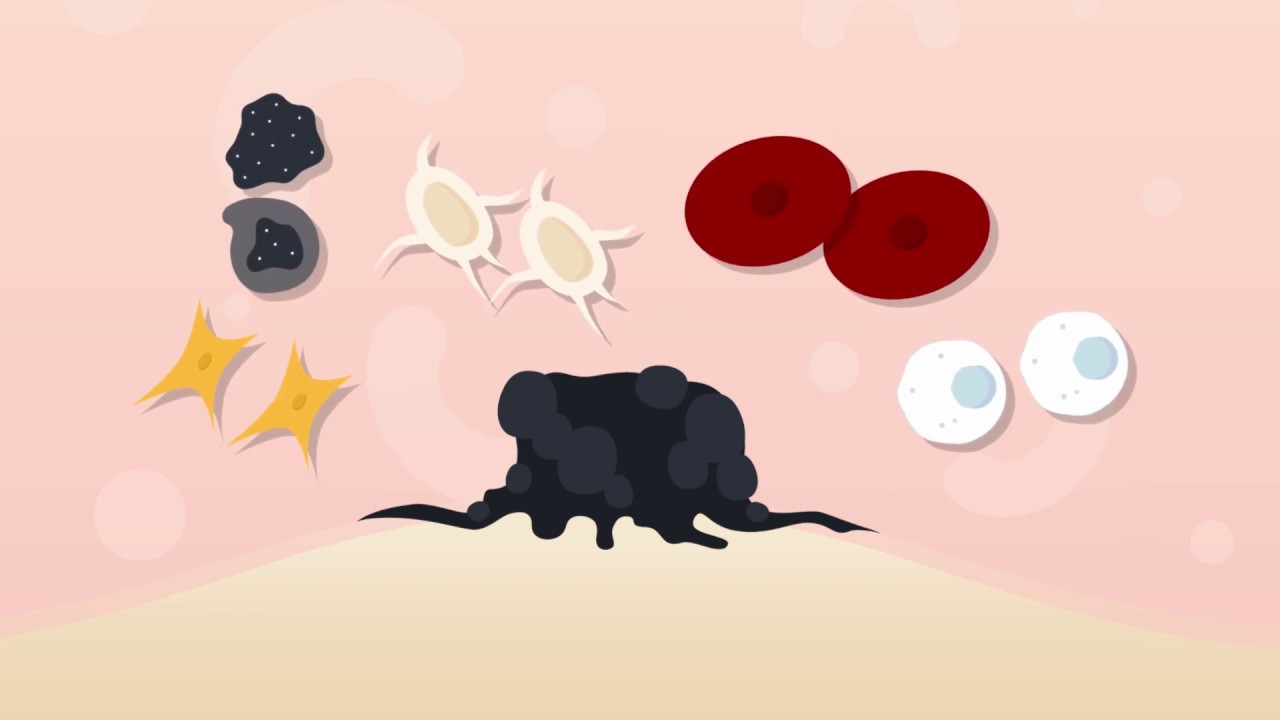 Cancer Cell Culture: Diversity of Cells in the Tumor Microenvironment (TME)