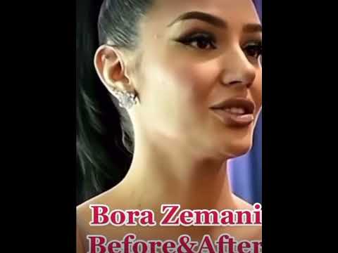 Bora Zemani Before&After#shorts
