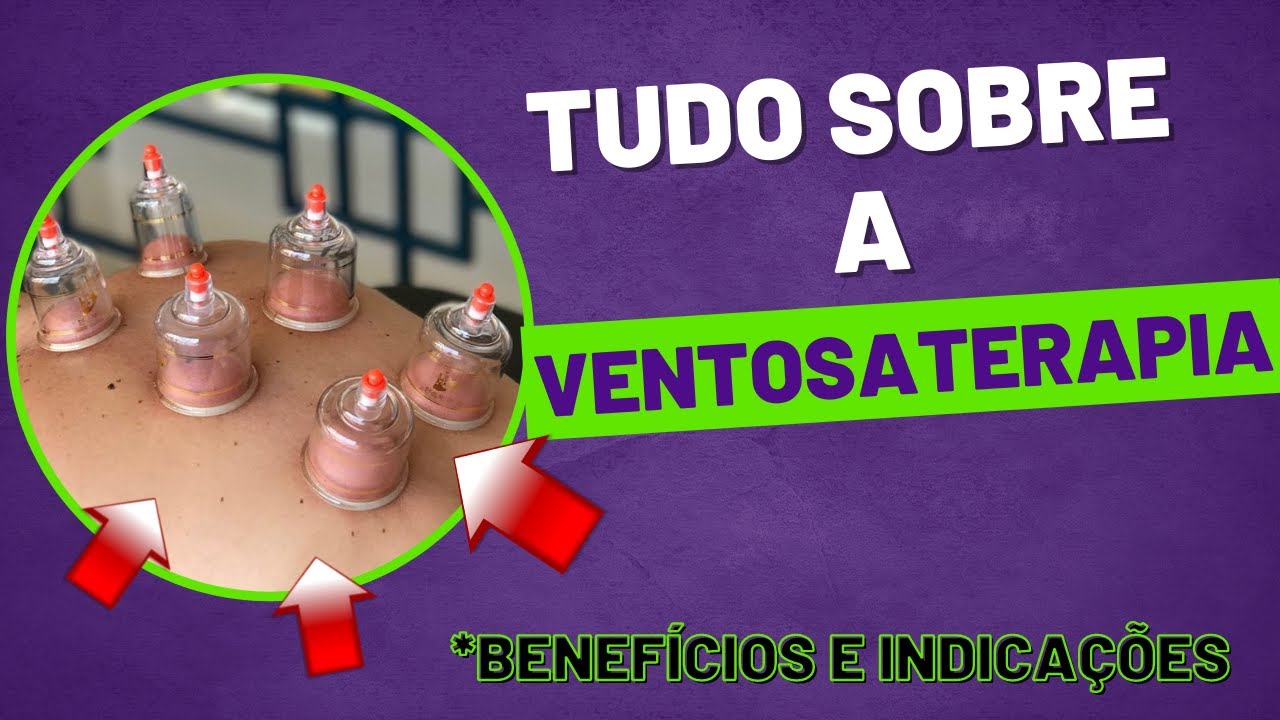 VENTOSATERAPIA - Pra quê serve? FUNCIONA? Tudo sobre a Ventosaterapia.