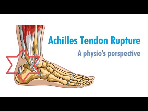 Physio Ruptures Achilles Tendon | week 1 after surgery