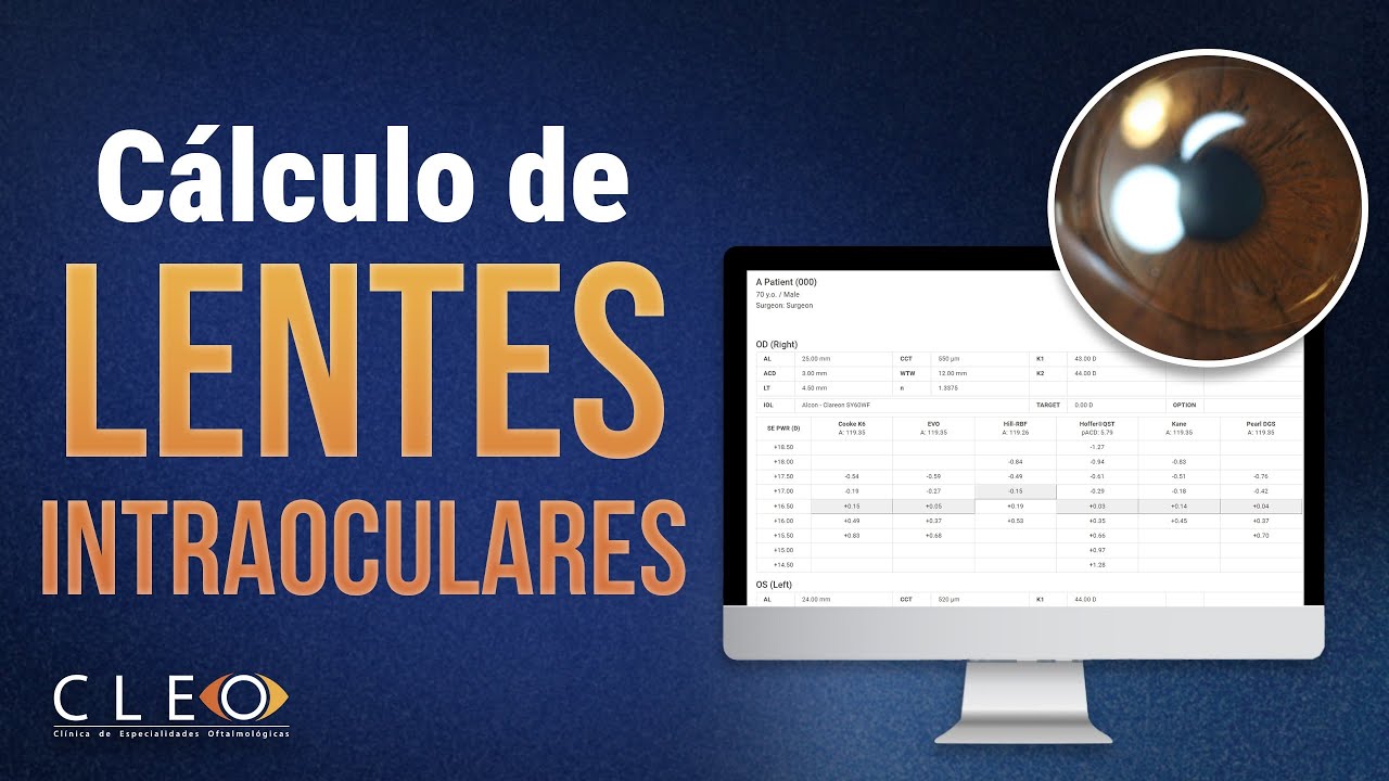 CÁLCULO DE LENTES INTRAOCULARES (LIOS)