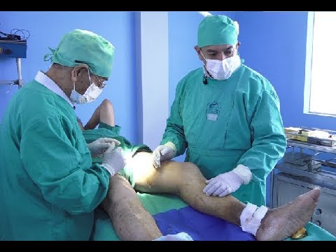 varicoza nici un tratament la domiciliu