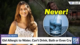 Girl Allergic to Water, Can’t Drink, Bath or Even Cry