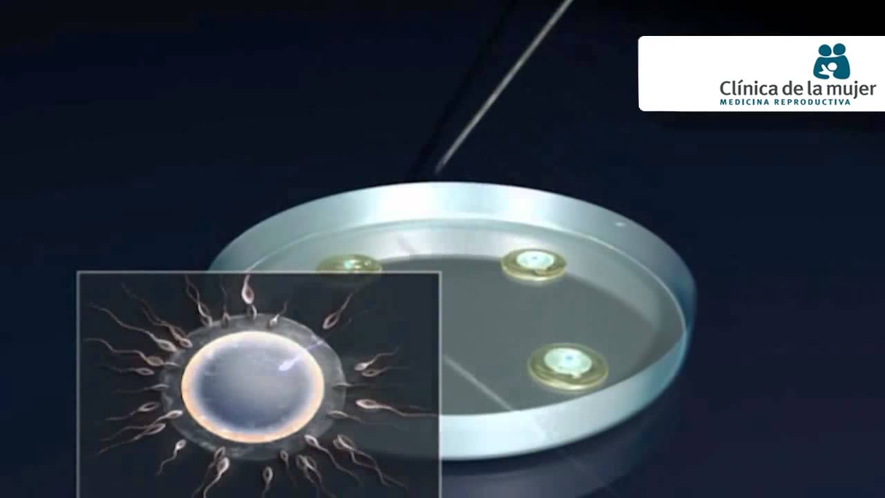 José Antonio Moreno-3