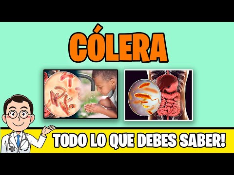 CHOLERA: what it is, SYMPTOMS, Pathophysiology | FULL TOPIC