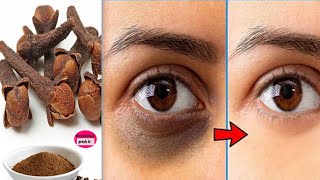 Naturally remove dark circles under eyes in 3 days /  Clove remedy for dark circles under eyes