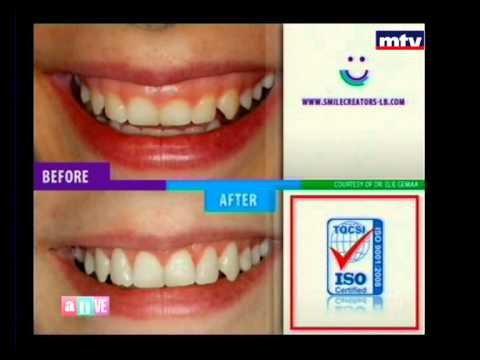 Window Beauty - Smile Creators 12/06/2014