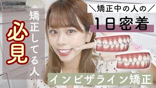 【これから歯列矯正始める人必見⭐️】矯正してる人の1日の過ごし方✨絶対使った方がいいオススメ矯正・セルフホワイトニングアイテムも紹介?♩【インビザライン 矯正】
