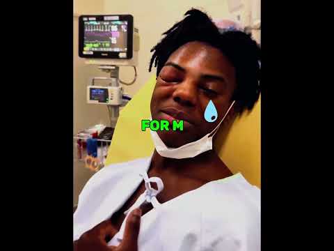 iShowSpeed got injured badly..