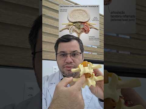 Marco Aurélio Severo Da Silva Versiani-92