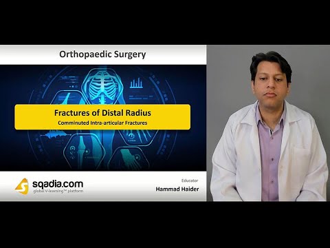 Fractures of Distal Radius | Comminuted Intra articular Fractures