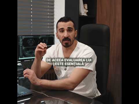 Ce trebuie să știi înaintea tratamentului cu implanturi?