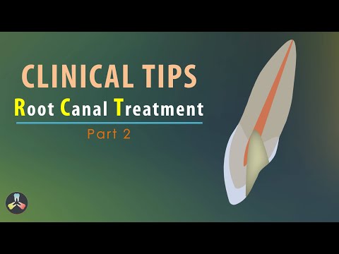 Root Canal Treatment | Clinical Tips | Part 2