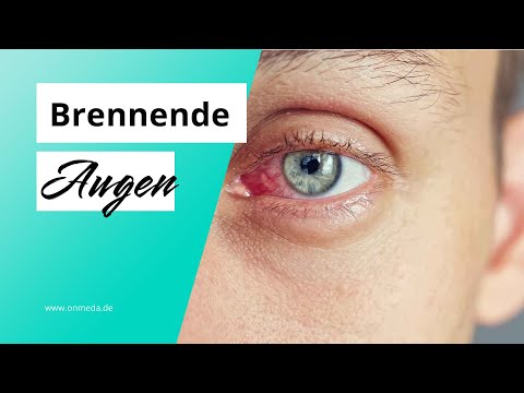 Brennende Augen: Das sind die Ursachen