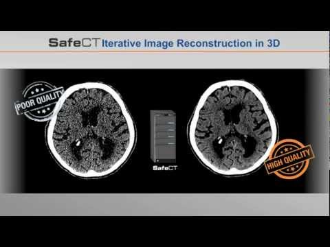 SafeCT low-dose CT imaging solution from Medic Vision logo