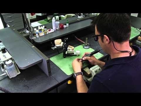 Wie wird eigentlich eine Zahnkrone hergestellt? - Mein Zahnarzt weiß das. Klinge & Kunstmann Kiel