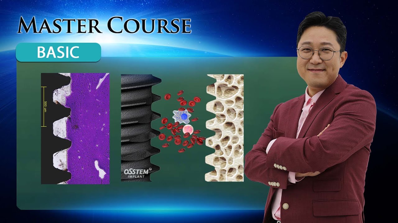[Master Course - BASIC] Implant PART 2