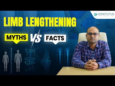 LIMB LENGTHENING MYTHS VS FACT