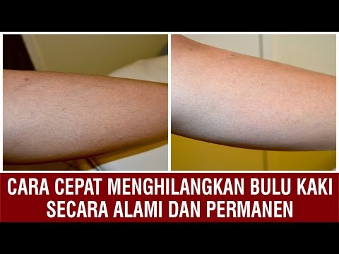 Anda dapat menghapus perut besar setelah melahirkan Pelangsing bit dan resep yogurt