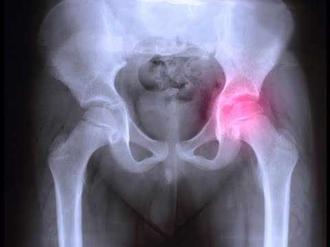 Prostata gonfia sintomi