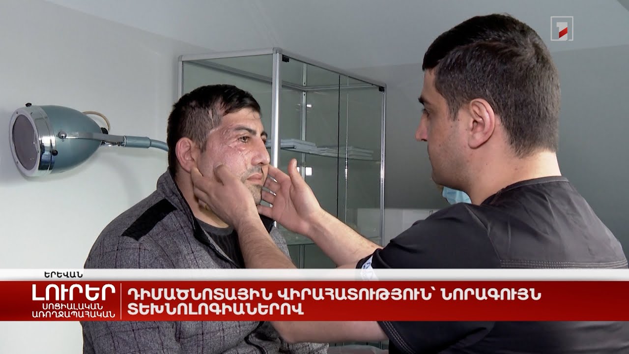 Դիմածնոտային վիրահատություն՝ նորագույն տեխնոլոգիաներով