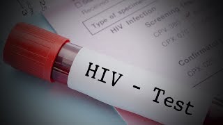 Treating HIV/AIDS with Cannabis