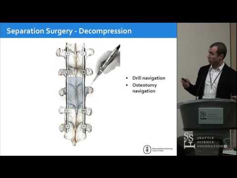 Navigation in Spine Tumor Surgery - Ilya Laufer, MD