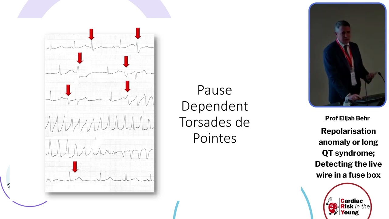 Repolarisation anomaly or long QT syndrome; Detecting the live wire in a fuse box - Prof Elijah Behr