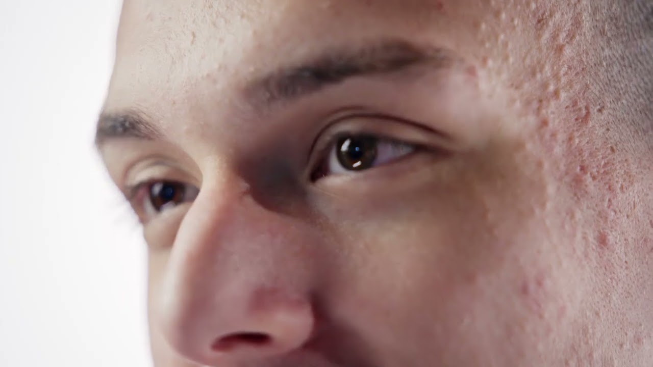 Finding a Way Forward : Will’s Career Story