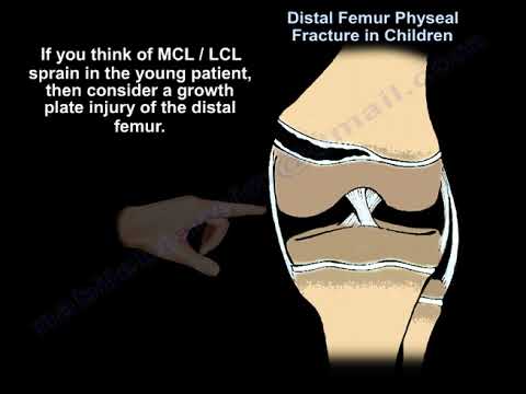 Fracture de la physe du fémur distal - Tout ce que vous devez savoir - Dr Nabil Ebraheim