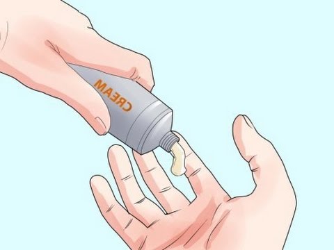 Siccome ha guarito leczema su mani un forum Chiarificazione di un organismo a psoriasi