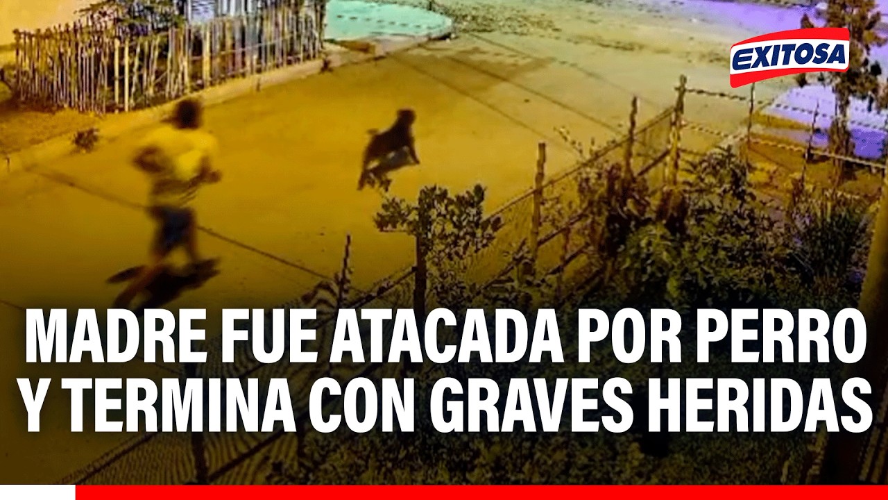 🔴🔵 Madre de familia sufre graves heridas en el rostro tras ser atacada por un perro en Ferreñafe
