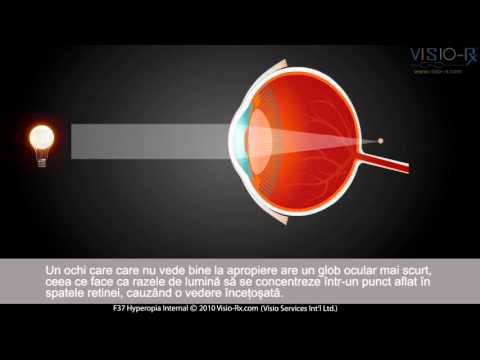 Antrenament îmbunătățirea miopiei vederii