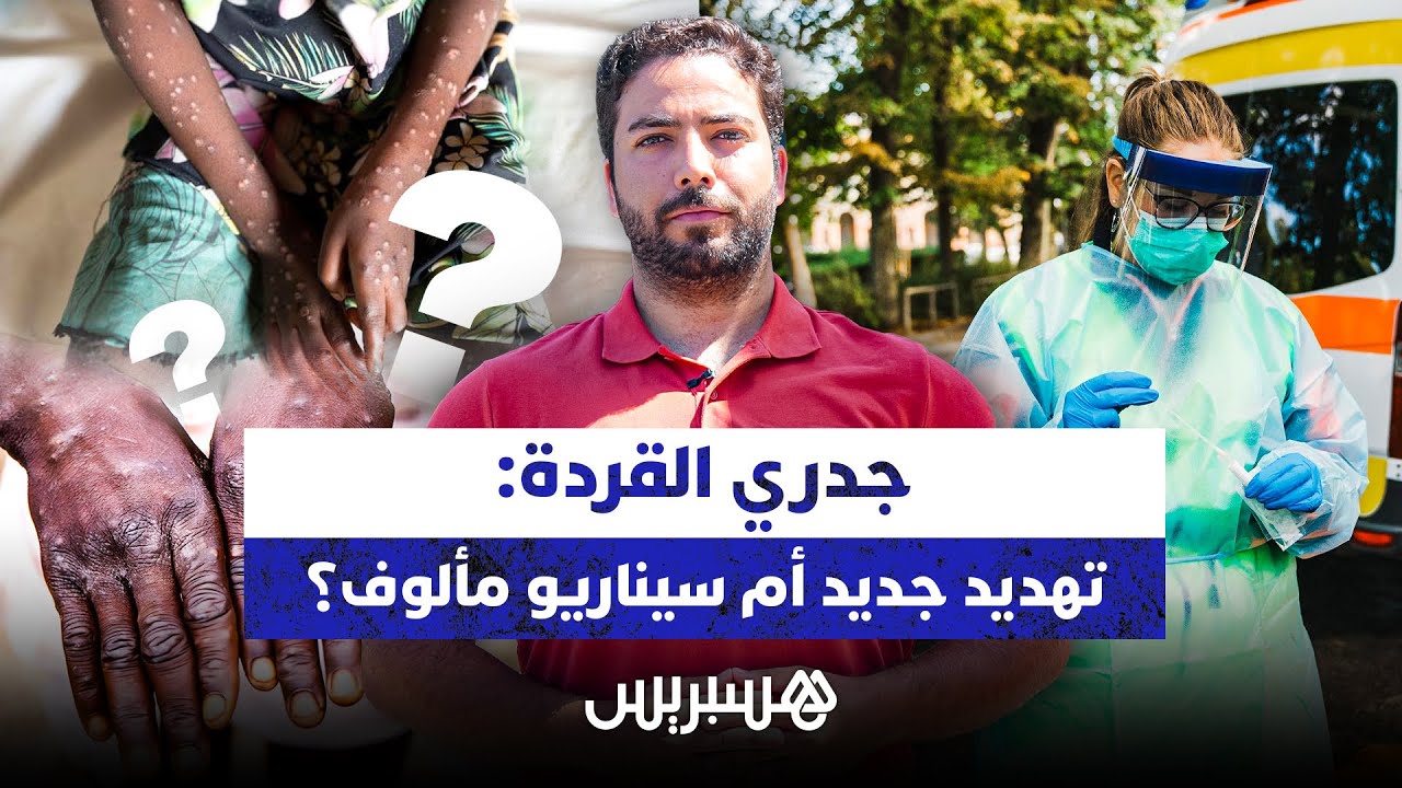 تهديد جديد أم سيناريو مألوف؟.. منظمة الصحة العالمية تعلن جدري القردة حالة طوارئ صحية عالمية thumbnail